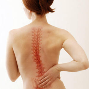 Symptoms-of-Scoliosis.jpg